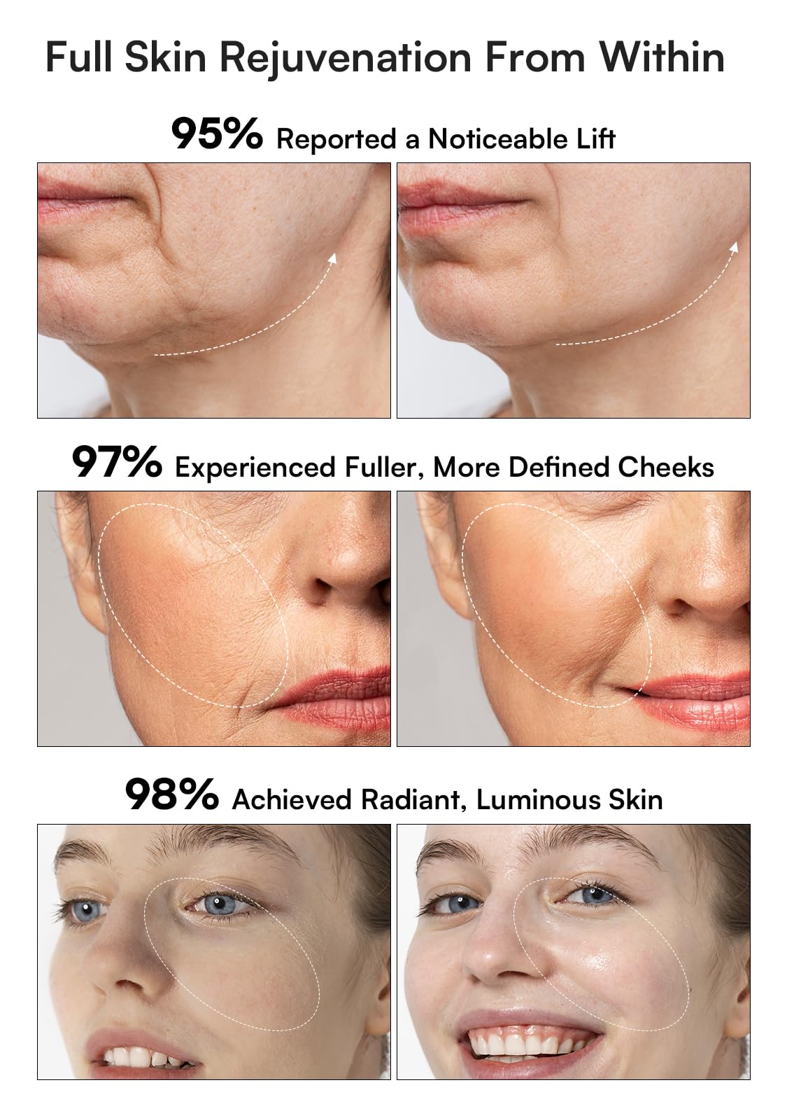 INIA 3-in-1 Red Light Therapy for Face and Neck Facial Massager True Beauty Glow Device, Lifting & Firming Skincare Tool